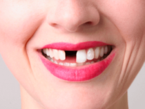 Ордо калаа тургундары стоматологиялык текшерүүдөн акысыз өтө алышат
