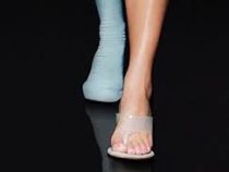 У Ким Кардашьян нашли шестой палец на ноге