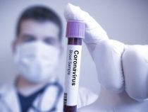 В Кыргызстане за минувшие сутки коронавирус выявлен еще у 22  человек