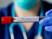 В Кыргызстане за минувшие сутки коронавирус выявлен еще у 14 человек