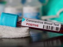В Кыргызстане зарегистрировано 14 новых случаев коронавируса
