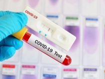 В Бишкек доставлены тесты  на коронавирус из Москвы и Минска