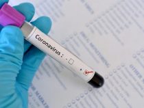 В Кыргызстане коронавирусом заразились еще шесть человек