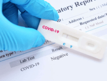 Во всех аптеках Кыргызстана будут продавать экспресс-тесты на коронавирус