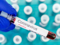 В Кыргызстане ситуация по коронавирусу стабильная