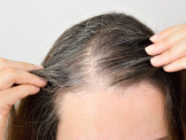 Названы причины раннего появления седых волос у женщин