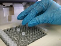 В ФБР назвали лабораторную утечку причиной пандемии коронавируса