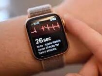 Часы Apple Watch можно превратить в трекер уровня стресса