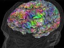 Новые наушники от Apple смогут составить карту вашего мозга