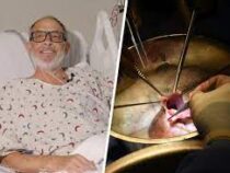 В США провели вторую в истории операцию по пересадке свиного сердца человеку
