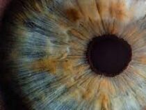 Американские врачи провели первую в истории пересадку человеку целого глаза